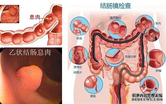 肠胃不好是为什么